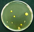 Bacterial Colonies Growing on an Agar Plate